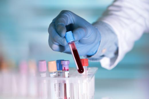 Buisjes afgenomen bloed in laboratorium
