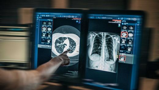Radiologisch beeld